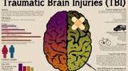 Know about Traumatic Brain Injury