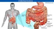 Prevent Irritable Bowel Syndrome
