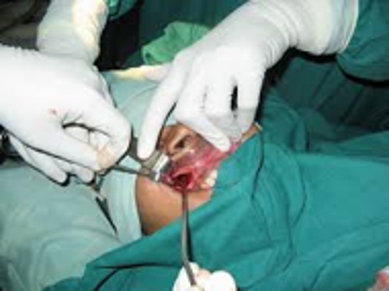 Maxillary Sinus Surgery