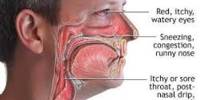 About Post Nasal Drip