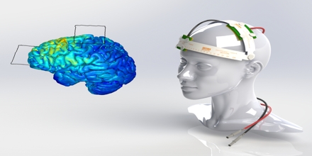 Electrical Brain Stimulation