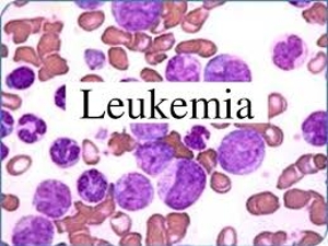 Know About Leukemia