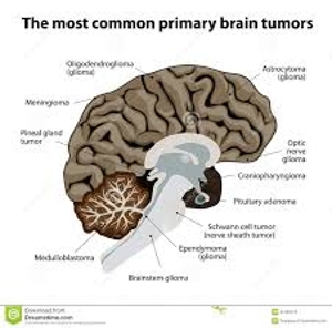 Types of Primary Brain Tumors