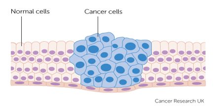 Lecture on Cancer