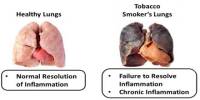 Lecture on Lung Disease