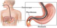 Lecture on Endoscopy