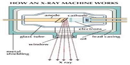 How X Rays Work?