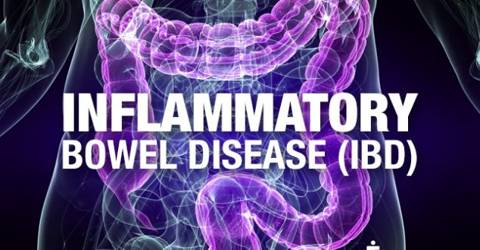 Inflammatory Bowel Disease: Symptoms and Treatments