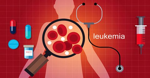 Symptoms and Treatment for Leukemia