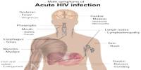 Socio Cultural Problems faced by People Living with HIV