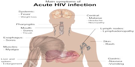 Socio Cultural Problems faced by People Living with HIV