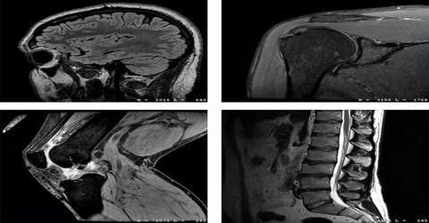 MRI: Magnetic Resonance Imaging