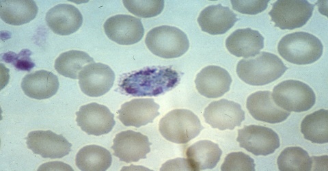 Plasmodium ovale