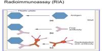 About Radioimmunoassay (RIA)