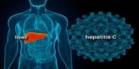Describe about Hepatitis C