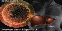 Overview about Hepatitis A