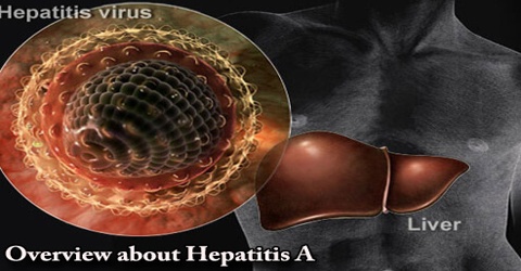 Overview about Hepatitis A