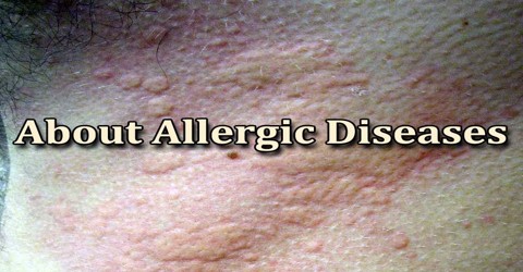 About Allergic Diseases