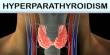 About Hyperparathyroidism