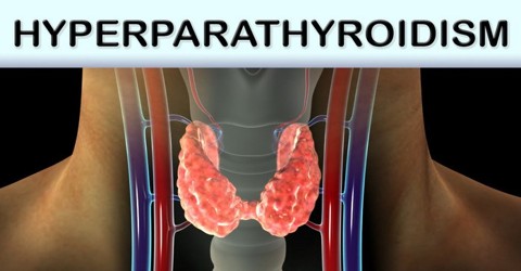 About Hyperparathyroidism