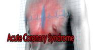 Acute Coronary Syndrome: Causes, Signs and Treatment