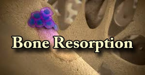 Bone Resorption - Assignment Point