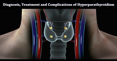 Diagnosis, Treatment and Complications of Hyperparathyroidism