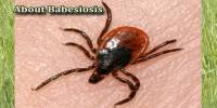 About Babesiosis