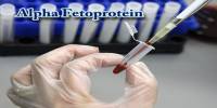 Alpha Fetoprotein