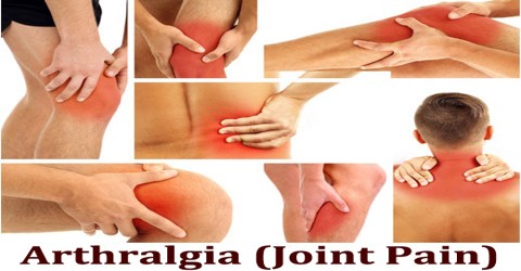 Arthralgia (Joint Pain)