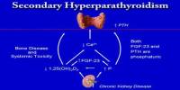 Secondary Hyperparathyroidism