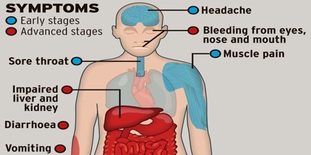 Viral Hemorrhagic Fever Assignment Point Viral Hemorrhagic Fever Assignment Point