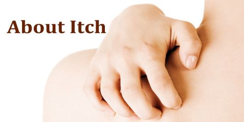 About Itch