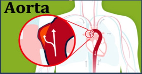 Aorta