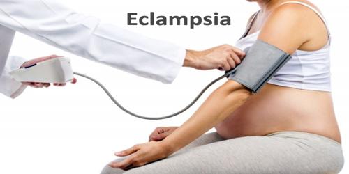 Eclampsia