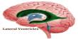 Lateral Ventricles
