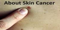 About Skin Cancer