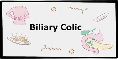Biliary Colic