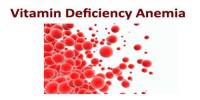 Vitamin Deficiency Anemia