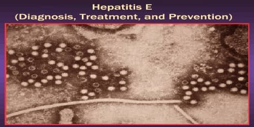 Hepatitis E (Diagnosis, Treatment, and Prevention)