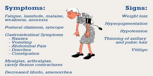 adrenal-insufficiency-assignment-point