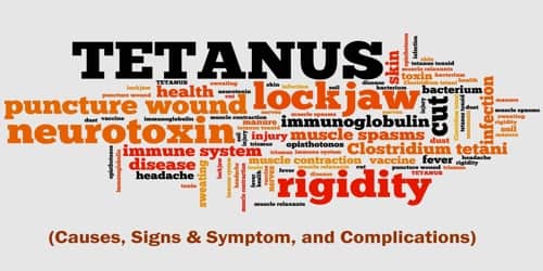 Tetanus (Causes, Symptom, and Complications)