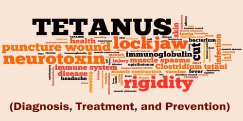 Tetanus (Diagnosis, Treatment, and Prevention)