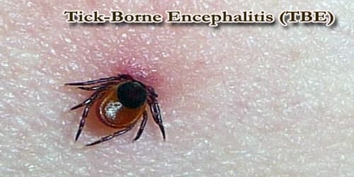Tick-Borne Encephalitis (TBE)