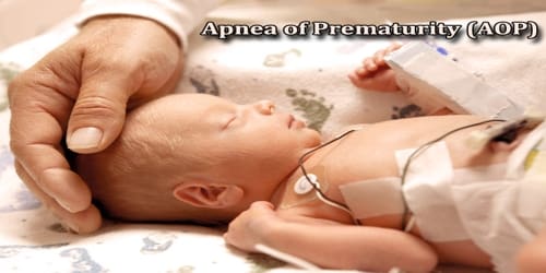 Apnea of Prematurity (AOP)