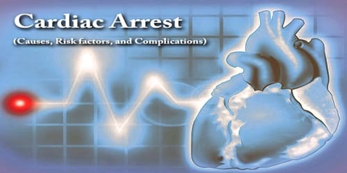 Cardiac Arrest (Causes, Risk factors, and Complications)