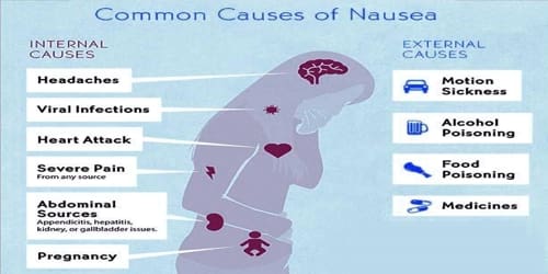 nausea-assignment-point