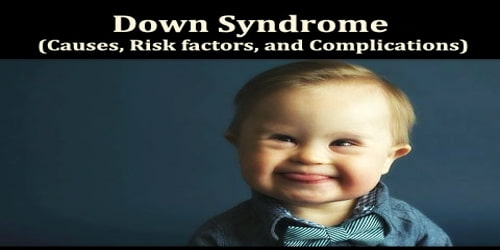 Down Syndrome (Causes, Risk factors, and Complications)