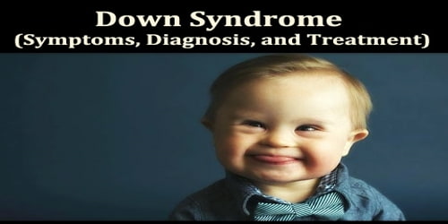 Down Syndrome (Symptoms, Diagnosis, and Treatment)