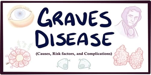 Graves’ Disease (Causes, Risk factors, and Complications)